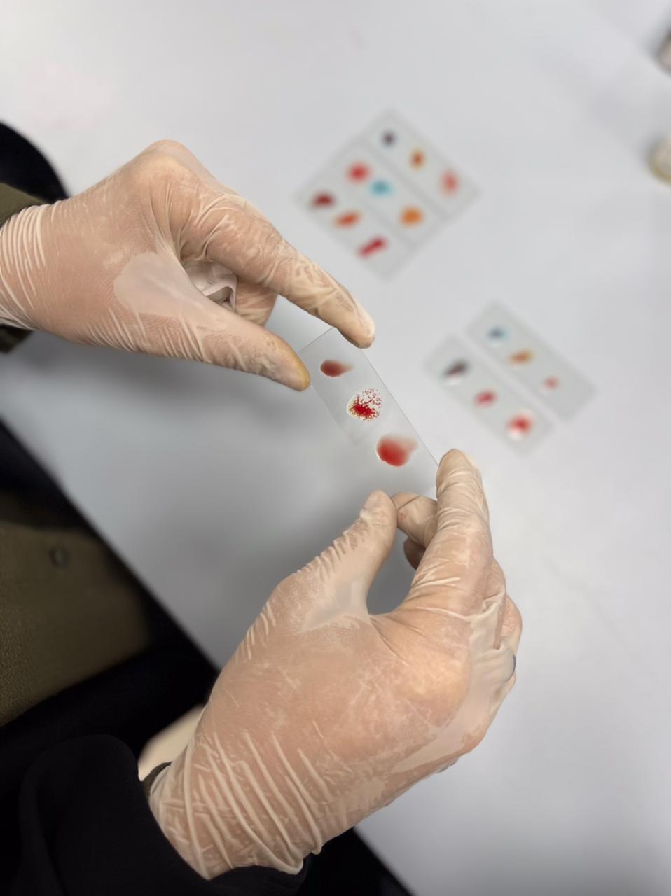 Blood Types and Rh Factor